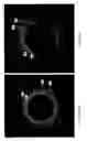 Fig. 10 - Identification of elastic lamina to guide interventional therapy