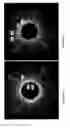 Fig. 12 - Identification of elastic lamina to guide interventional therapy