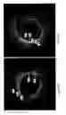 Fig. 13 - Identification of elastic lamina to guide interventional therapy