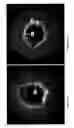 Fig. 15 - Identification of elastic lamina to guide interventional therapy