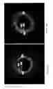Fig. 17 - Identification of elastic lamina to guide interventional therapy