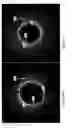 Fig. 19 - Identification of elastic lamina to guide interventional therapy