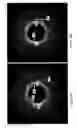 Fig. 20 - Identification of elastic lamina to guide interventional therapy