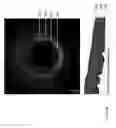Fig. 30 - Identification of elastic lamina to guide interventional therapy