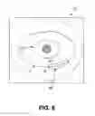 Fig. 33 - Identification of elastic lamina to guide interventional therapy
