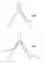 Fig. 14 - TISSUE ACCESS SITE SYSTEM AND METHOD