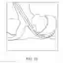 Fig. 18 - Devices and methods for tissue access
