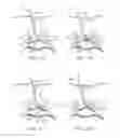 Fig. 68 - Devices and methods for tissue access