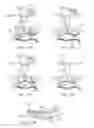 Fig. 75 - Devices and methods for tissue access