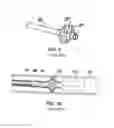 Fig. 05 - TEMPORARY VASCULAR SCAFFOLD AND SCORING DEVICE