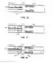 Fig. 07 - TEMPORARY VASCULAR SCAFFOLD AND SCORING DEVICE