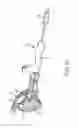Fig. 14 - Method for placing a cannula in a bladder