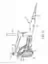 Fig. 15 - Method for placing a cannula in a bladder