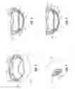 Fig. 05 - Method and structure for selectively locking portions of a seal assembly