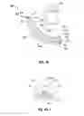 Fig. 11 - SURGICAL INTRODUCER AND ACCESS PORT ASSEMBLY
