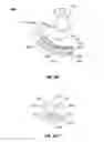 Fig. 15 - SURGICAL INTRODUCER AND ACCESS PORT ASSEMBLY