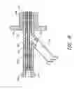 Fig. 06 - Expandable percutaneous sheath