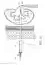 Fig. 09 - Expandable percutaneous sheath