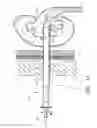 Fig. 10 - Expandable percutaneous sheath