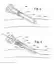 Fig. 03 - Transradial access devices, systems, and methods