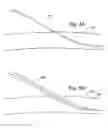 Fig. 04 - Transradial access devices, systems, and methods