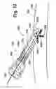 Fig. 10 - Transradial access devices, systems, and methods