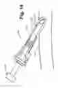 Fig. 12 - Transradial access devices, systems, and methods