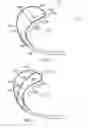 Fig. 04 - Intrauterine balloon apparatus, system, and method for augmenting uterine birthing forces during parturition