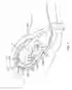 Fig. 06 - Intrauterine balloon apparatus, system, and method for augmenting uterine birthing forces during parturition