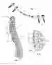 Fig. 04 - GROWING SPINAL RODS AND PEDICLE SCREWS FOR SECURING MULTIPLE SPINAL RODS
