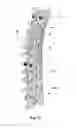 Fig. 07 - GROWING SPINAL RODS AND PEDICLE SCREWS FOR SECURING MULTIPLE SPINAL RODS