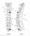 Fig. 12 - GROWING SPINAL RODS AND PEDICLE SCREWS FOR SECURING MULTIPLE SPINAL RODS