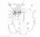 Fig. 01 - Spinal implant system and method