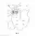 Fig. 03 - Spinal implant system and method