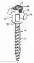 Fig. 01 - Receiving part for receiving a rod for coupling the rod to a bone anchoring element