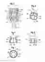 Fig. 03 - Receiving part for receiving a rod for coupling the rod to a bone anchoring element