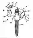 Fig. 01 - Offset variable angle connection assembly