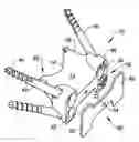 Fig. 01 - Interlaminar, interspinous stabilization devices for the cervical spine