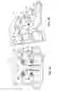 Fig. 06 - Interlaminar, interspinous stabilization devices for the cervical spine