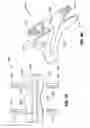 Fig. 07 - Interlaminar, interspinous stabilization devices for the cervical spine