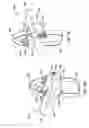 Fig. 10 - Interlaminar, interspinous stabilization devices for the cervical spine