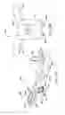 Fig. 15 - Interlaminar, interspinous stabilization devices for the cervical spine