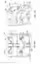 Fig. 17 - Interlaminar, interspinous stabilization devices for the cervical spine