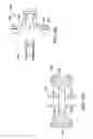 Fig. 19 - Interlaminar, interspinous stabilization devices for the cervical spine