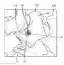 Fig. 01 - Facet screw and method for spinal stabilization