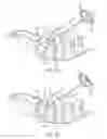 Fig. 09 - Facet screw and method for spinal stabilization