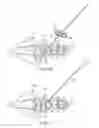 Fig. 10 - Facet screw and method for spinal stabilization