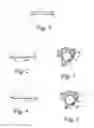 Fig. 02 - LAMINOPLASTY DEVICE