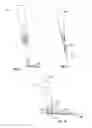 Fig. 10 - Percutaneous vertebral stabilization system
