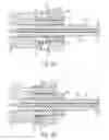 Fig. 13 - Bone anchors and surgical instruments with integrated guide tips